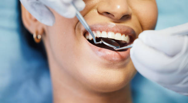 Best Walk-In Emergency Dentist in Julian, CA